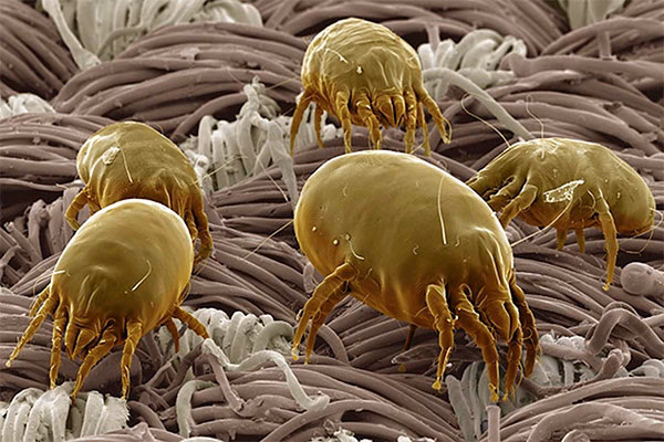 ¿Cómo puedo deshacerme de los ácaros en mi sofá?