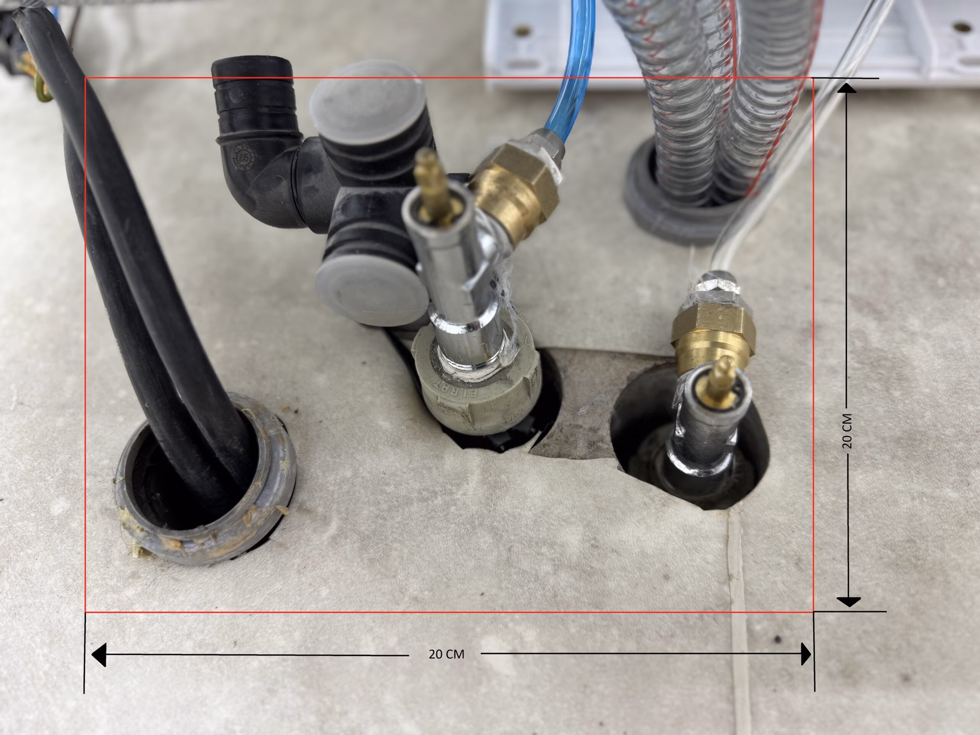 ¿Cómo funciona la succión dental?