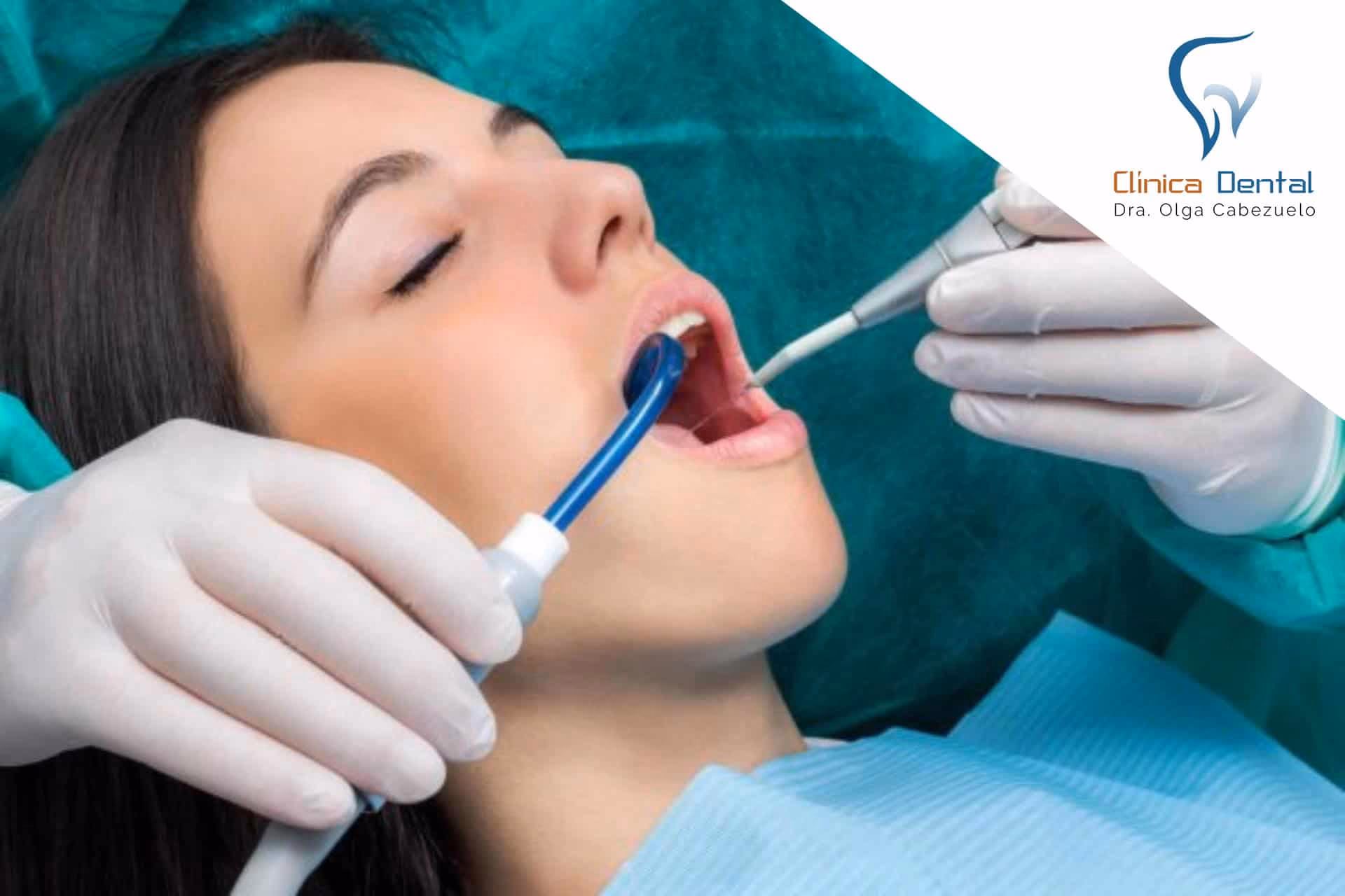 ¿Cómo funciona la succión del sillón dental?