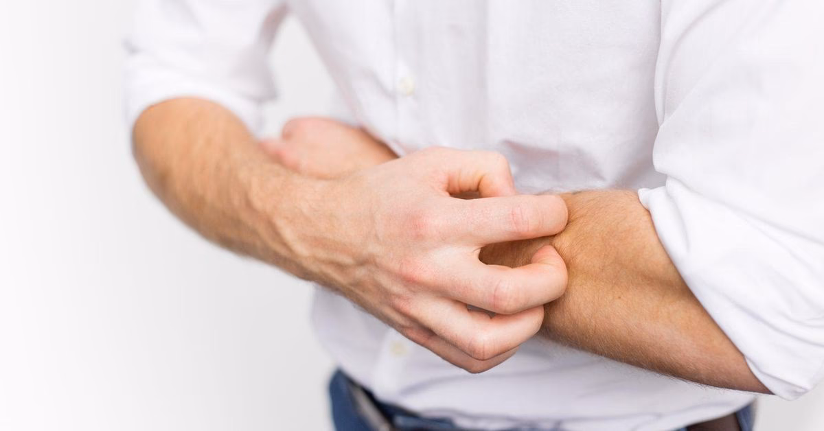 ¿Cómo muere el ácaro de la sarna?