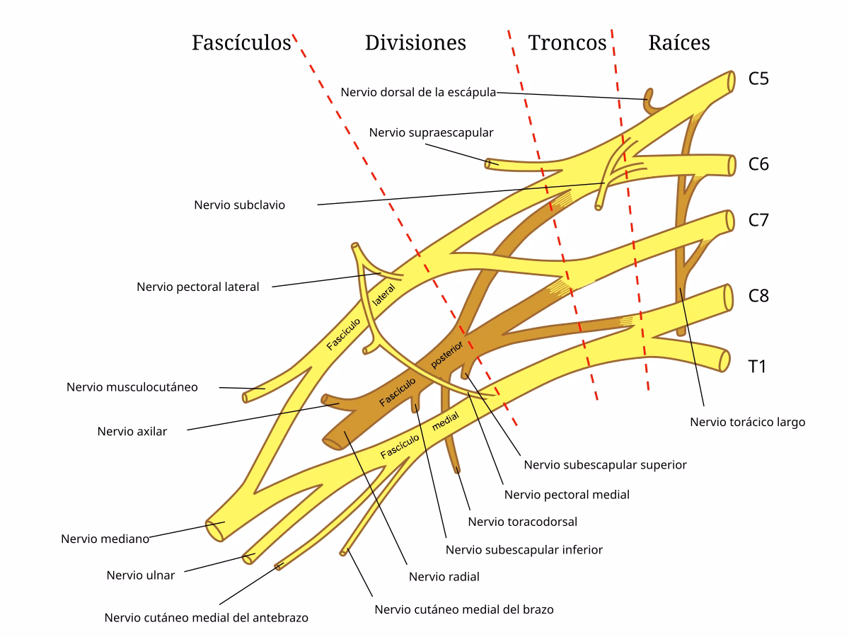 ¿Cuáles son los síntomas de un tumor del plexo braquial?