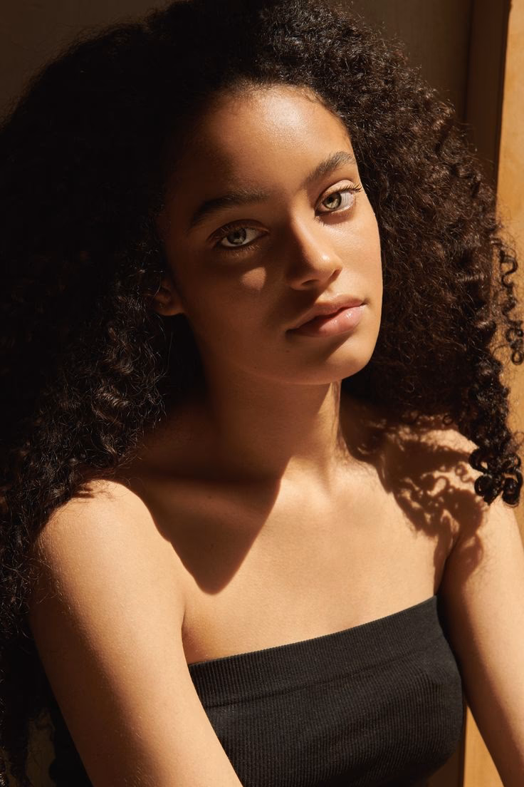 ¿Qué es el síndrome genético del cabello rizado?